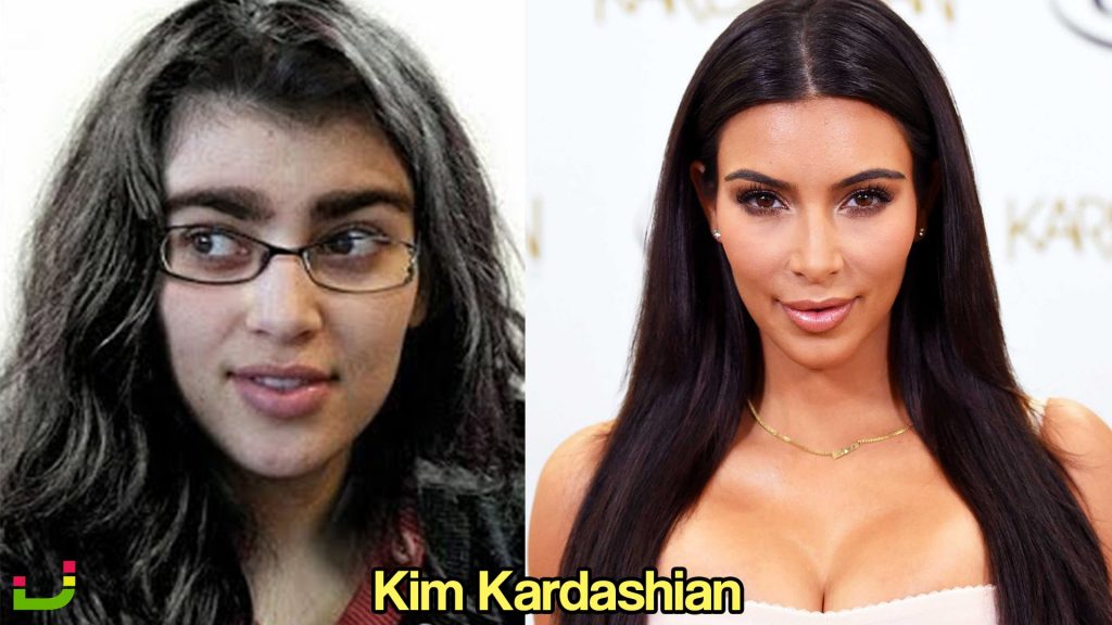 Shocking Celebrities Before and After Fame!