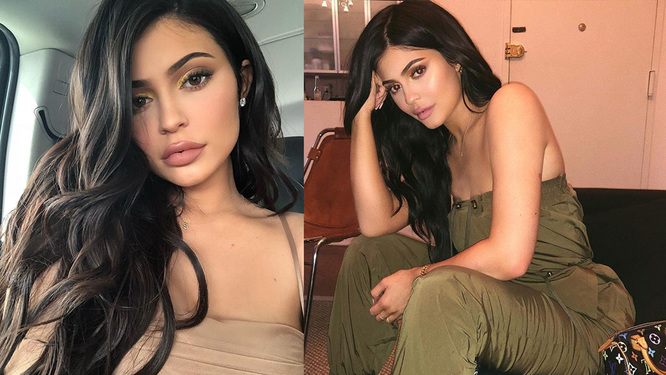 Did Kylie Jenner get Plastic Surgery AGAIN?!